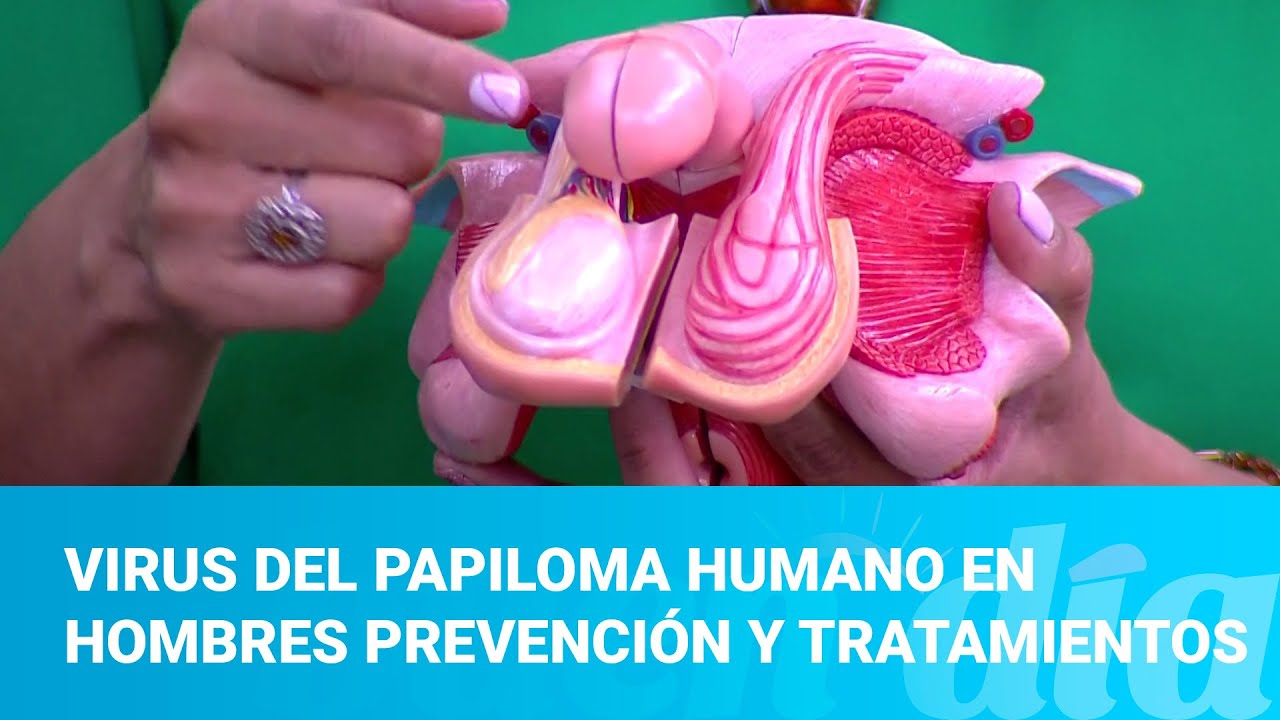 Virus del papiloma humano en hombres prevenci&oacute;n y tratamientos