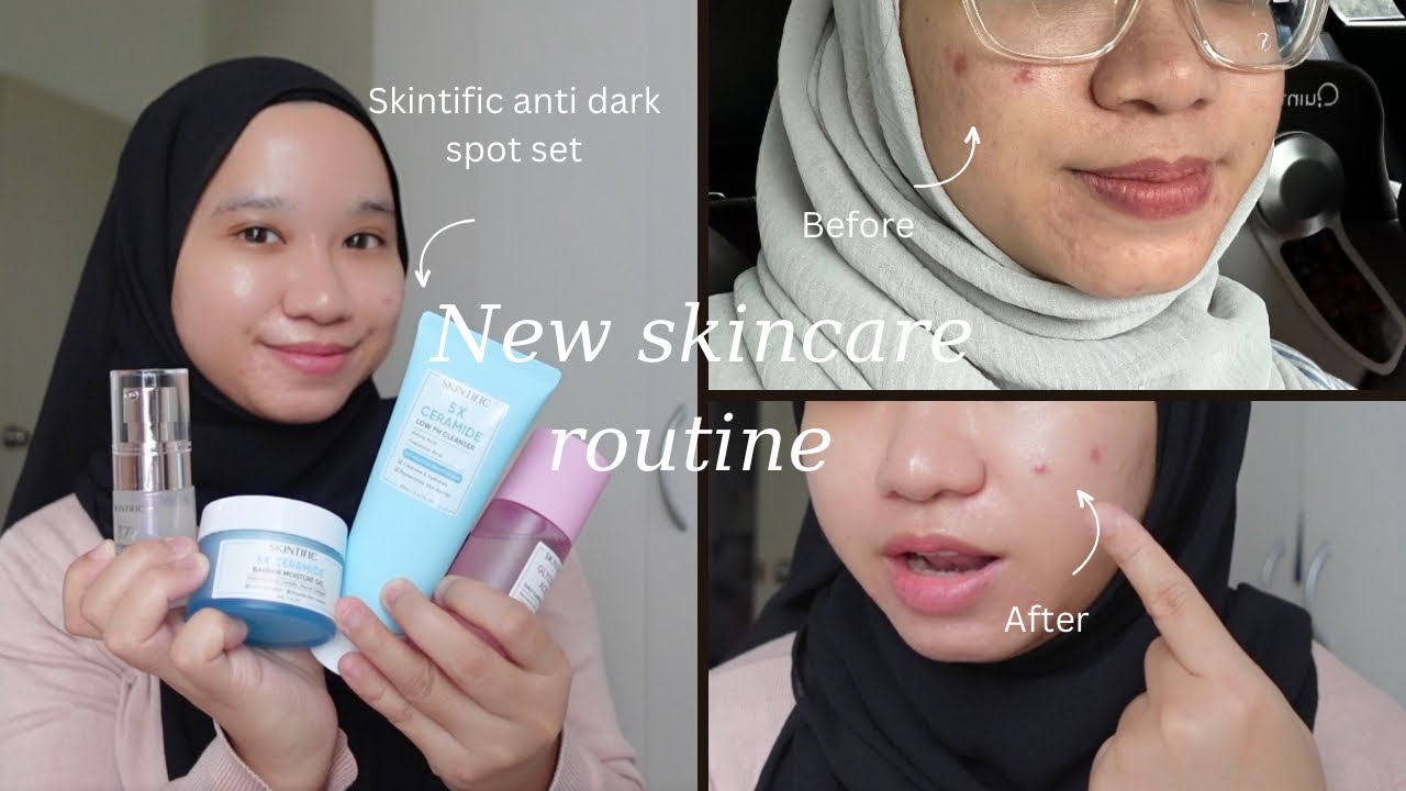 My NEW skincare routine using SKINTIFIC ANTI DARK SPOT SET (really works wonder!!!!) | Skincare