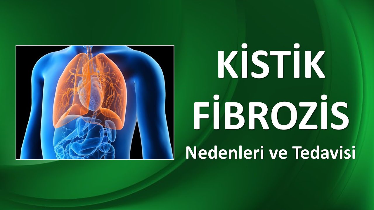 KİSTİK FİBROZİS NEDİR? NEDEN OLUR?
