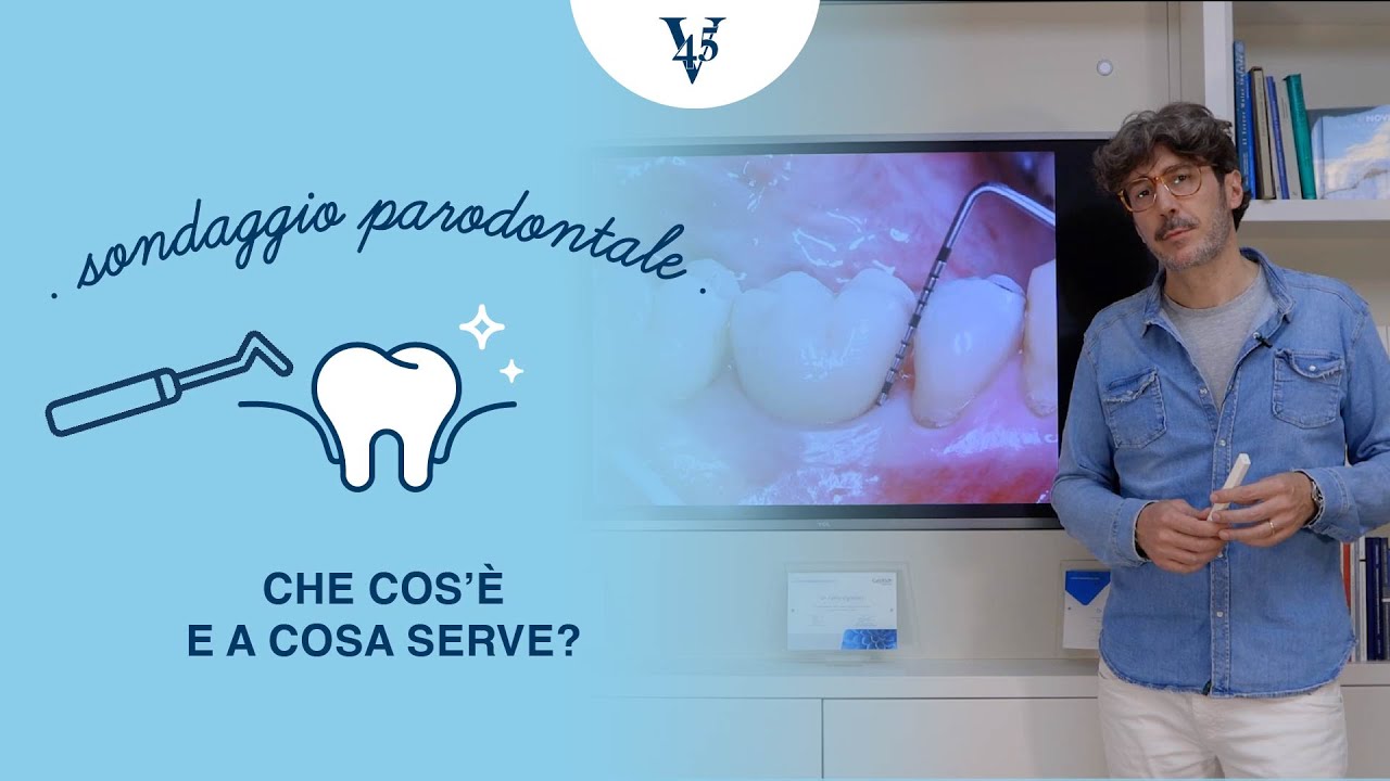 Sondaggio: che cos’è e a cosa serve?