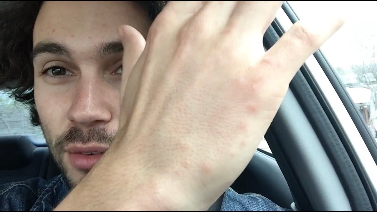 I THINK I HAVE BED BUGS 😱 || 24/7/365: Episode 82