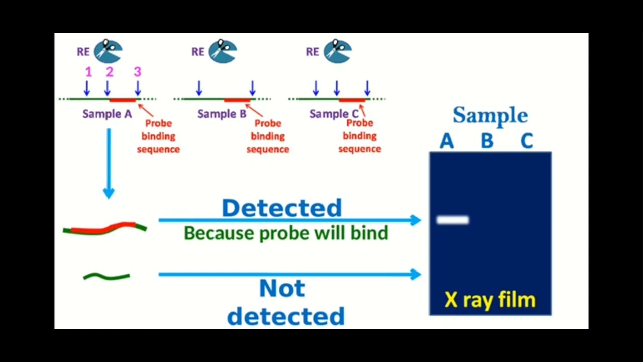 RFLP (partie 2)- SV- Génétique- Chapitre 3- Document 4