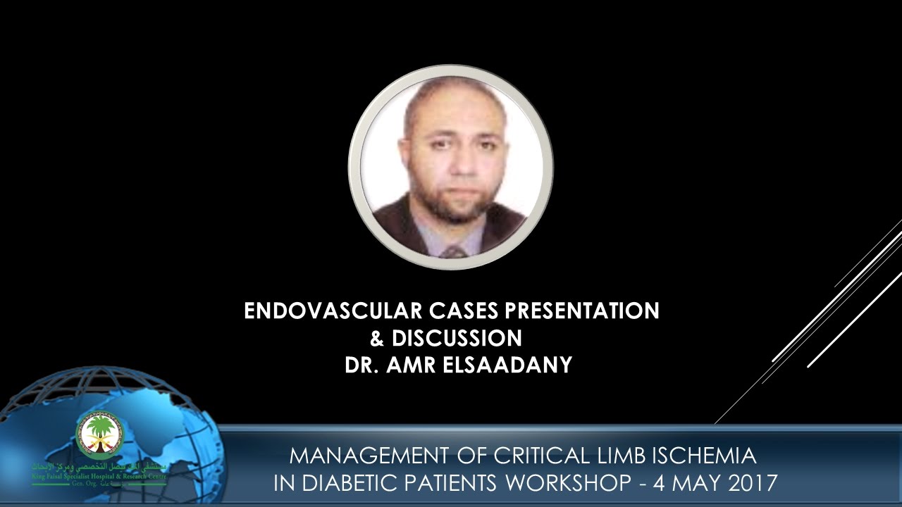 Endovascular Cases Presentation &ndash;  Dr  Amr Elsaadany   Discussion &ndash; Part II