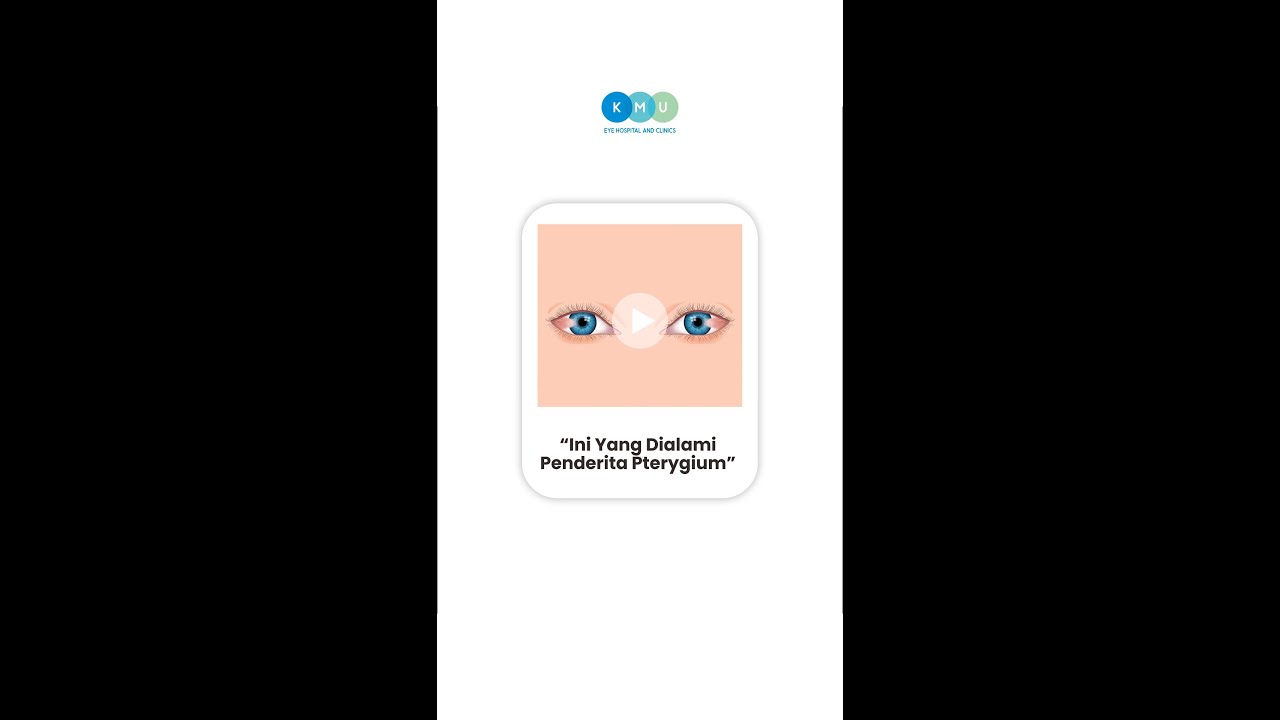 Ini Yang Dialami Penderita Pterygium