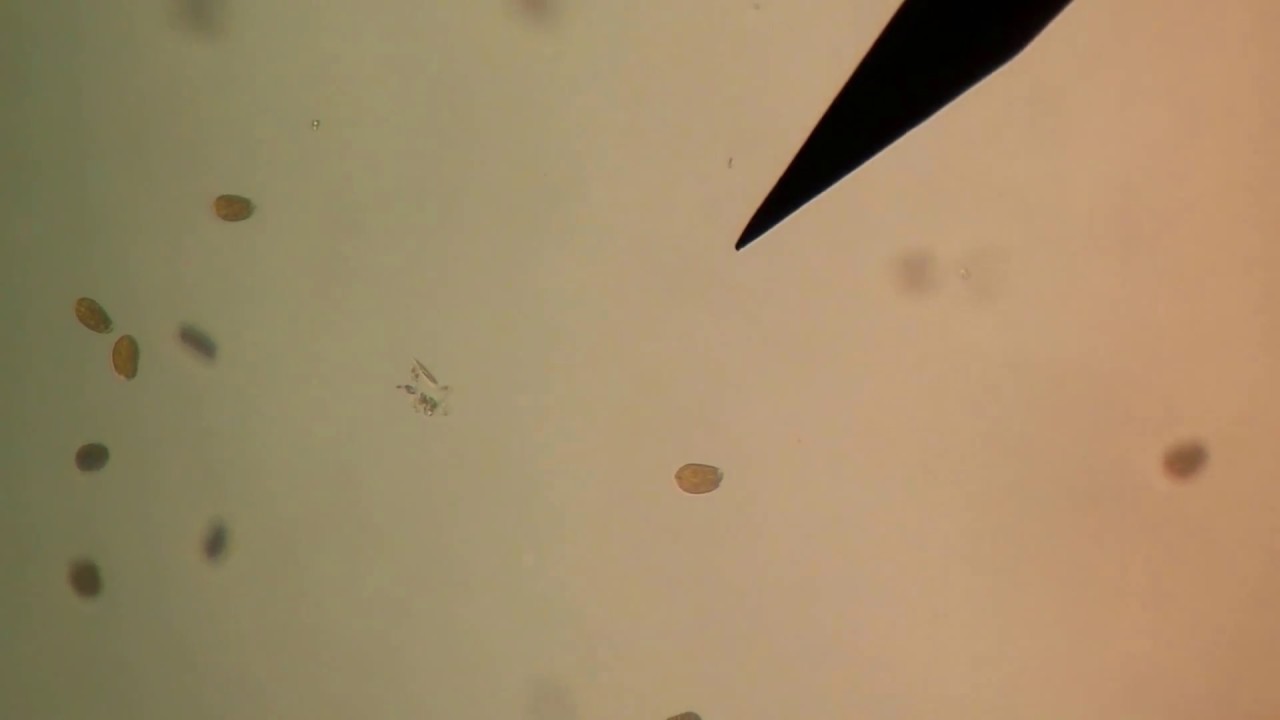 Amphidinium dinoflagellate