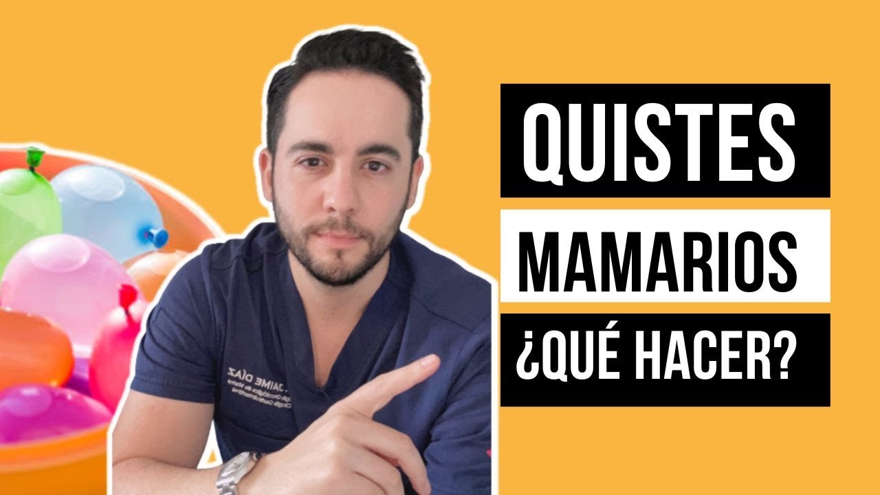 TODO sobre QUISTES MAMARIOS en 2 minutos