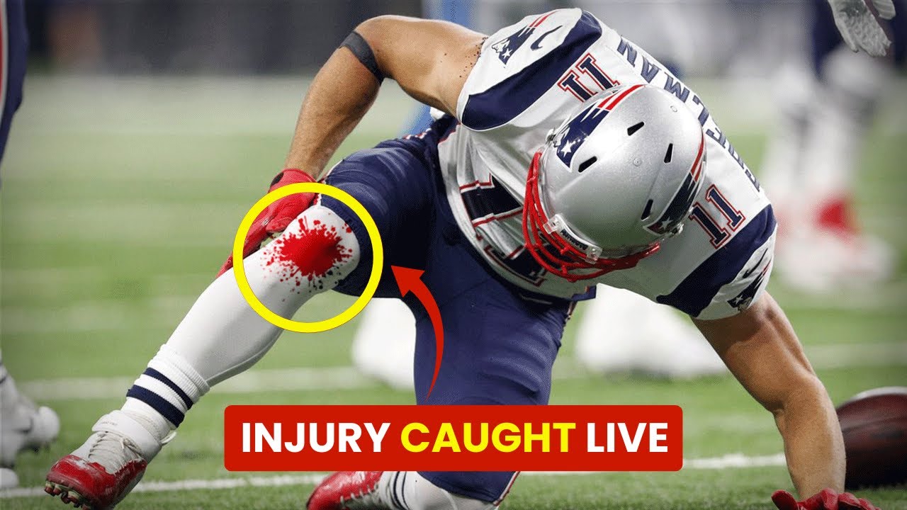Worst Injuries in the history of NFL #nfl2025