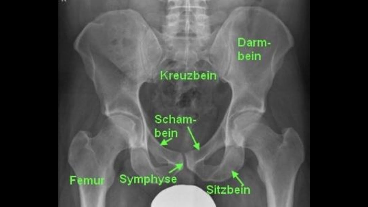 Beckenkochen: verständlich erklärt