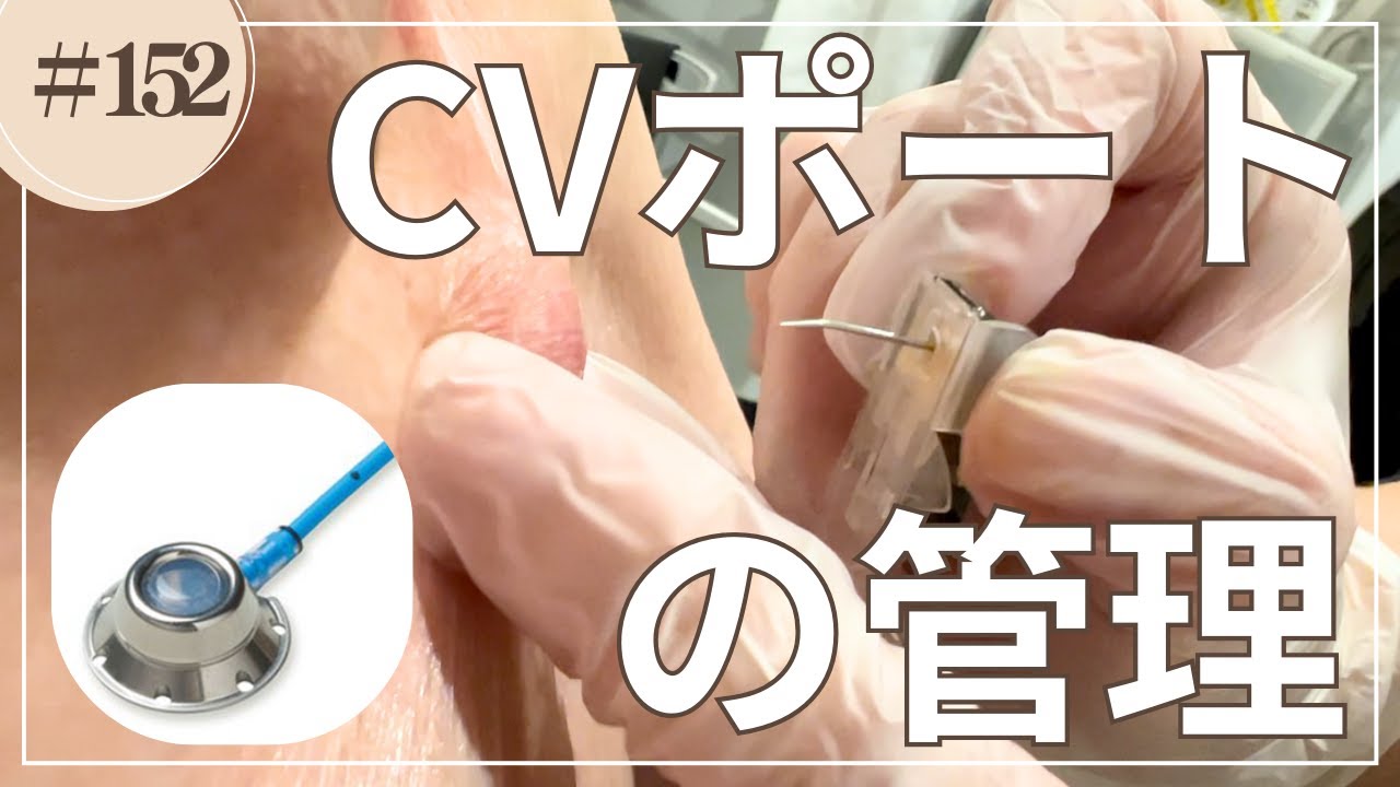 #152   CVポートの管理