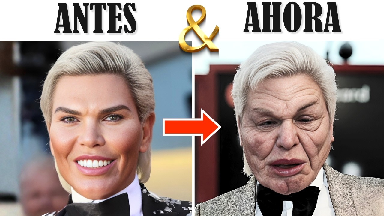 10 Desastres de Cirugía Plástica de Celebridades que Impactaron a Hollywood