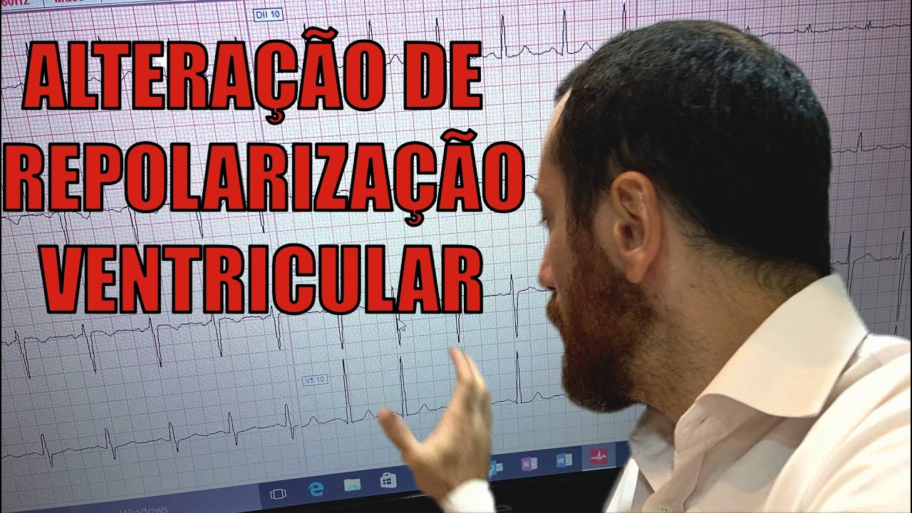 ALTERAÇÃO DE REPOLARIZAÇÃO VENTRICULAR, VEJA EXEMPLO NA PRÁTICA , CASO REAL