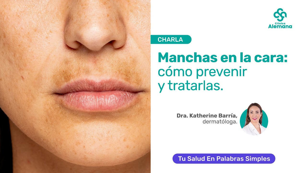 Manchas en la Cara: Cómo prevenir y tratarlas | Clínica Alemana