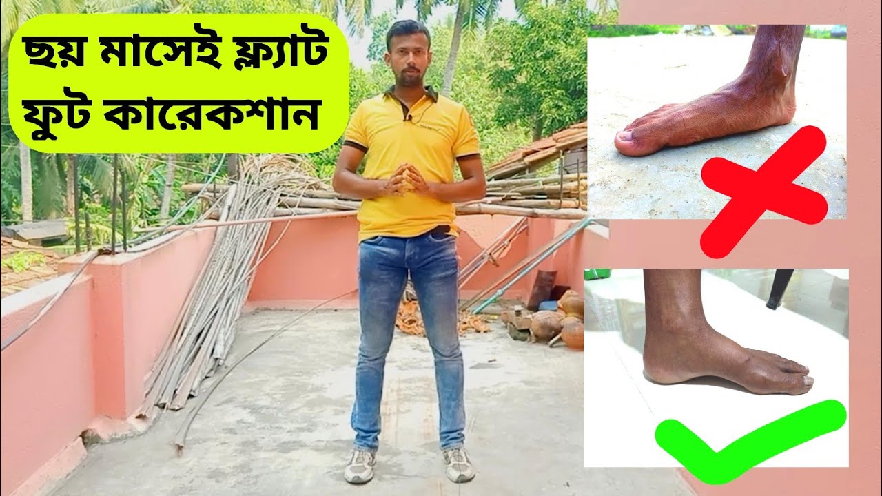 Flat Feet 6 Mahina Ka Andar Kayasa Thick Kara / Bangla / How To Remove Flat Foot Within 6 Month