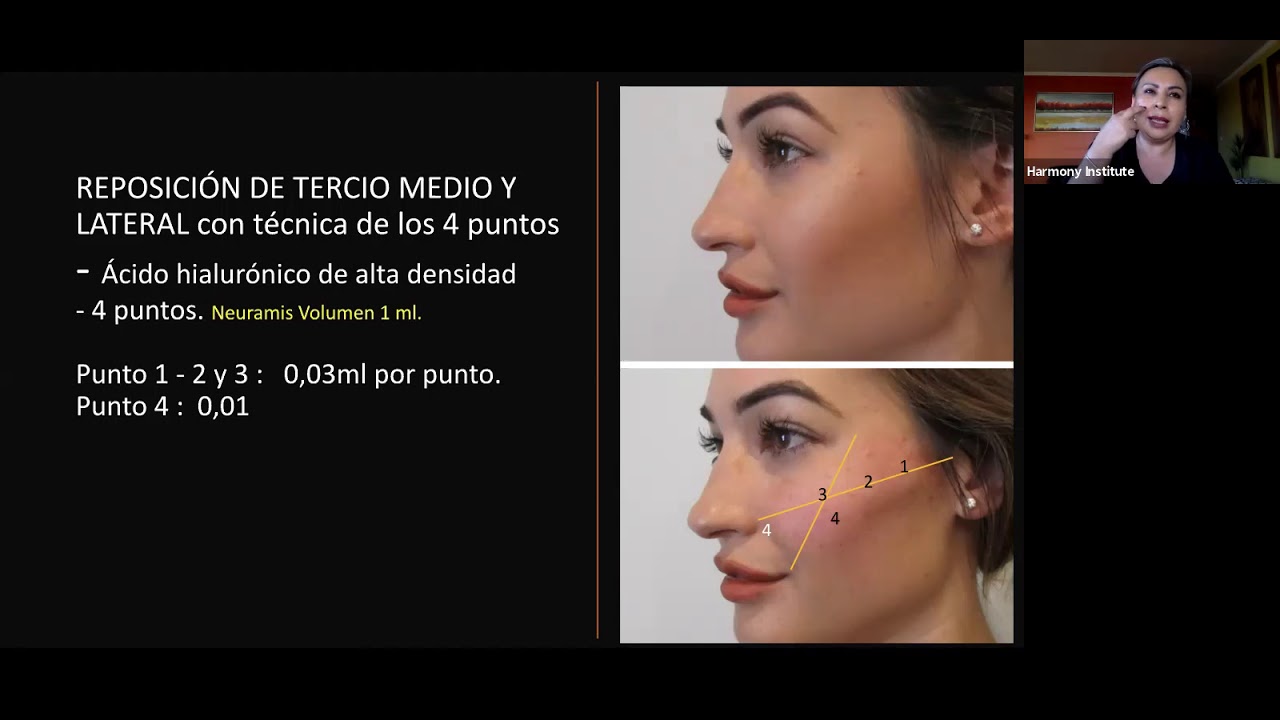 Webinar t&eacute;cnica 