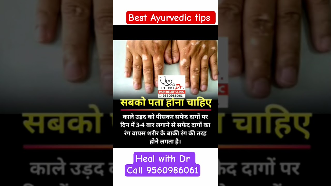 Kala Urad for White Spots 😯 | सफेद दाग का घरेलू इलाज | Ayurvedic Skin Care Tips in Hindi 