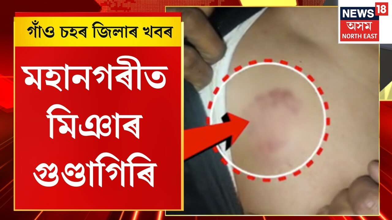 Assam News : গাঁও চহৰ জিলাৰ খবৰ। মহানগৰীত মিঞাৰ গুণ্ডাগিৰি। Guwahati Hit & Run |