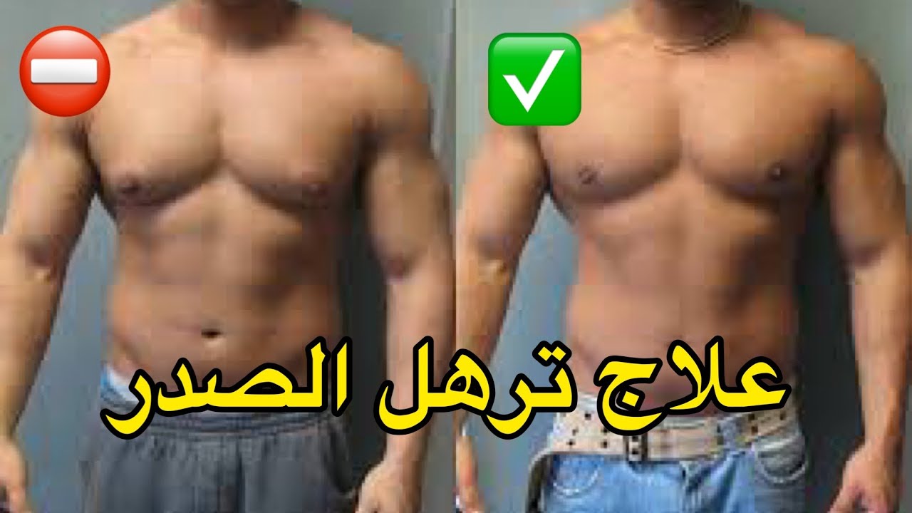 كيف تعالج ترهلات الصدر