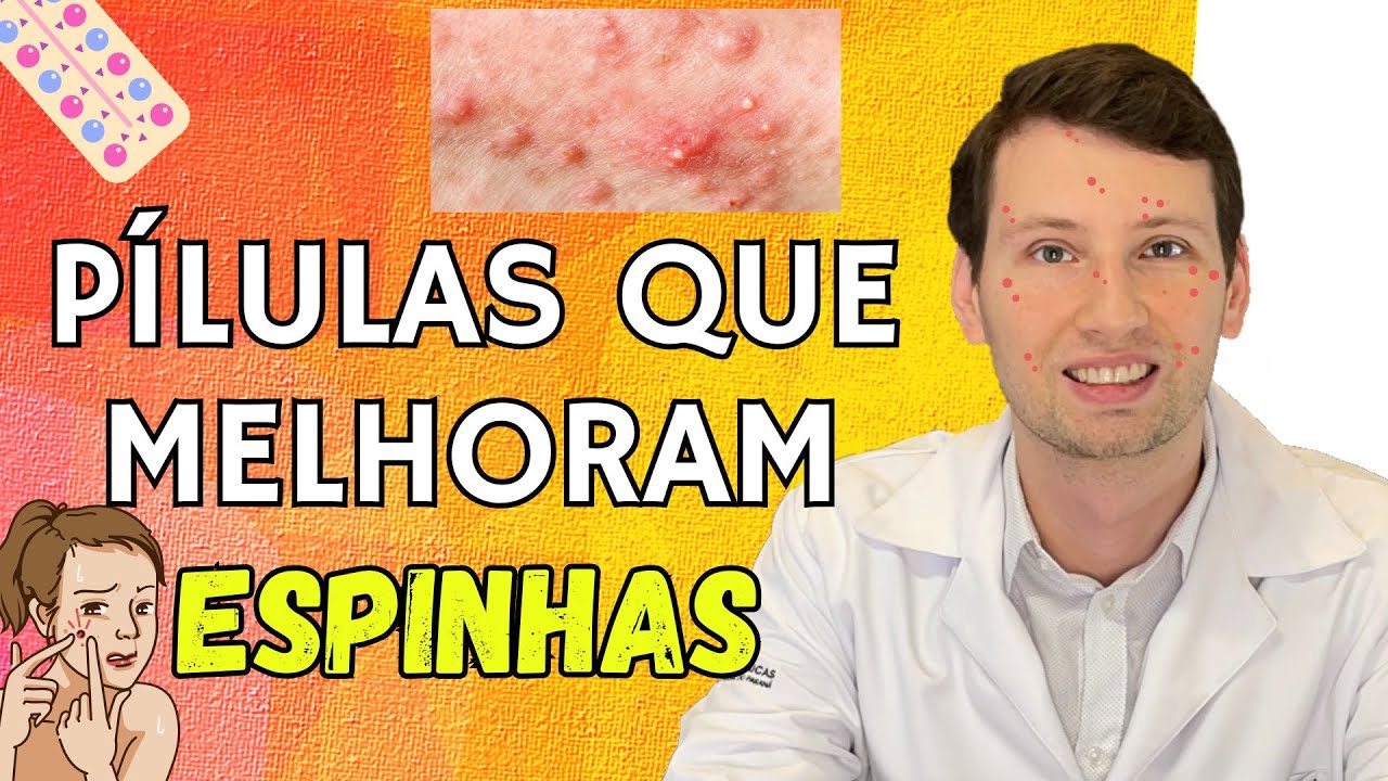 Anticoncepcionais para espinhas O Guia DEFINITIVO 2025 | Podcast Sem Jaleco  EP4