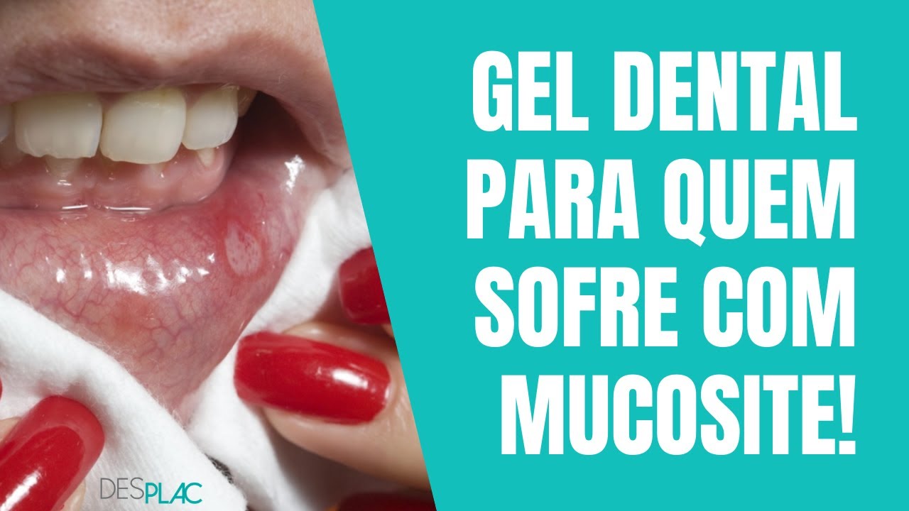 ESSE GEL É INDICADO PARA QUEM SOFRE DE MUCOSITE!