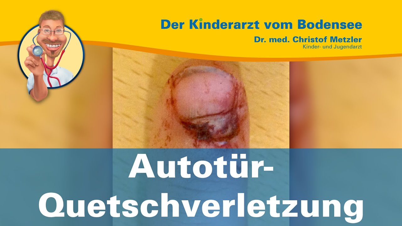 Autotür-Quetschverletzung - Der Kinderarzt vom Bodensee
