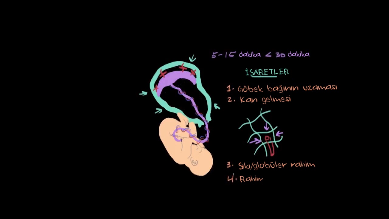 Uterus (Rahim) Dönmesi (Fen Bilimleri) (Sağlık ve Tıp)