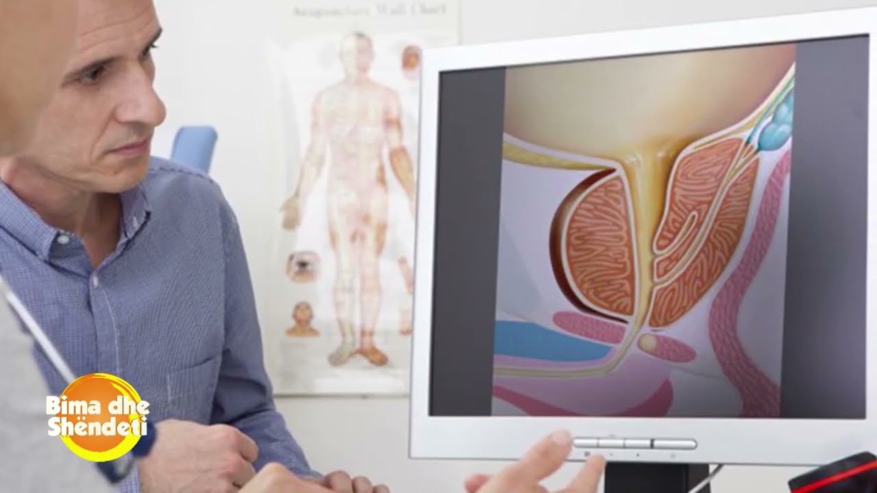 Ylli Merja: Prostata, bim&euml;t mjek&euml;sore m&euml; t&euml; rekomanduara