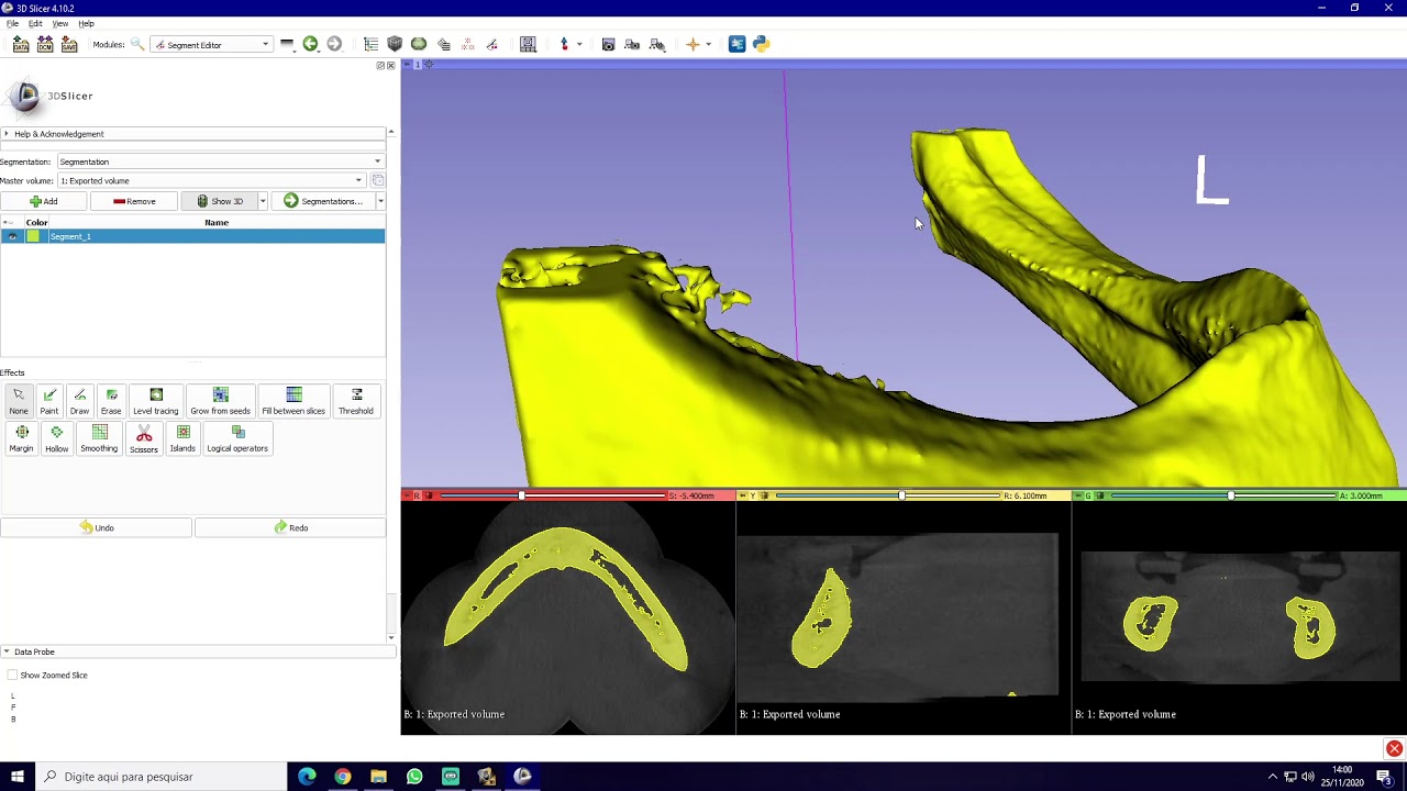 Como converter arquivos DICOM em STL para impressão 3D (Anycubic)