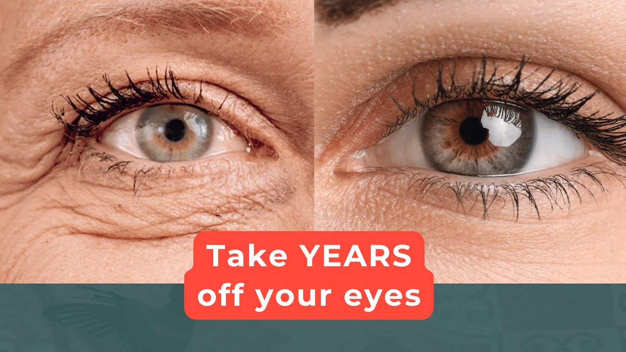 Everything you NEED to know about the CO2 Laser Eye lift