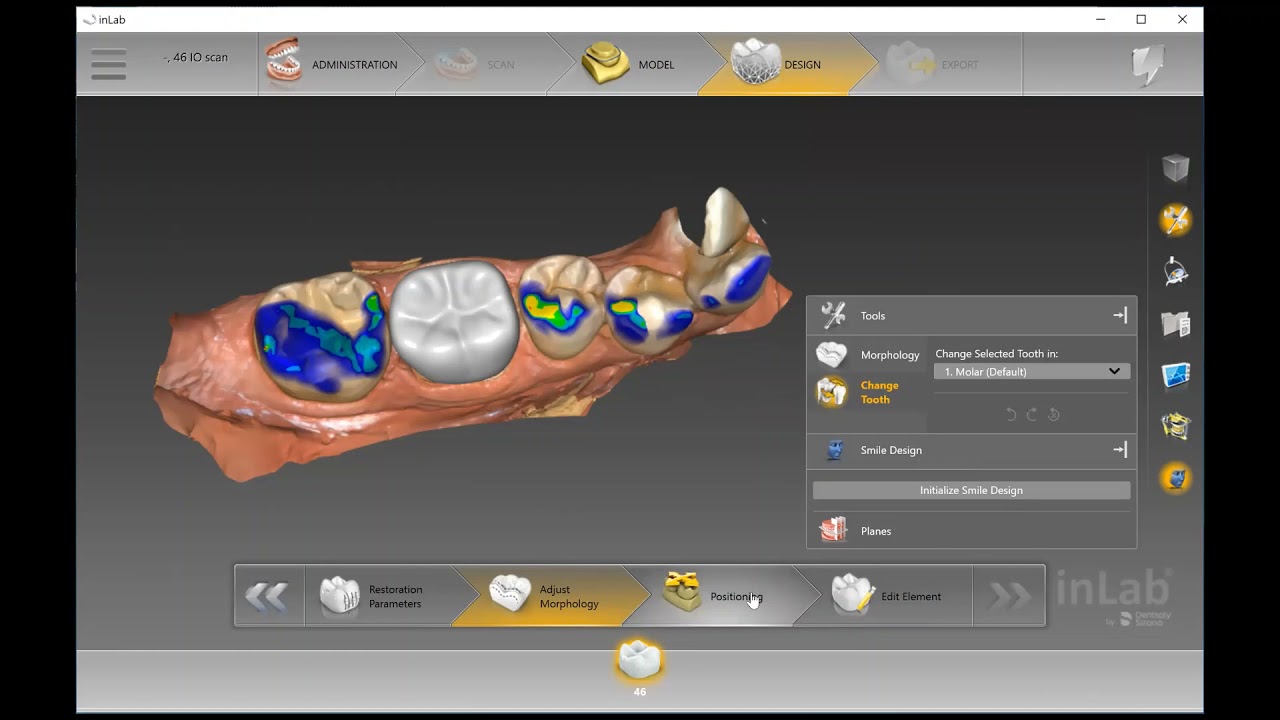 Crown Design Inlab Software 20