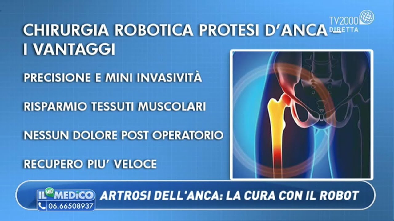 Il Mio Medico - Artrosi all'anca: la cura con il robot