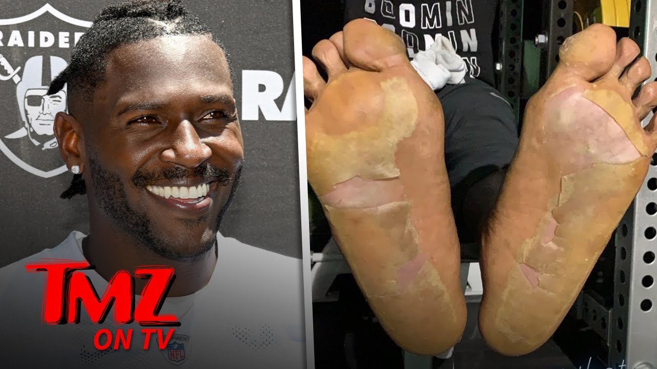 NFL Player's Disgusting Foot Injury Caused By 'Cryogenic Chamber Mishap' | TMZ TV