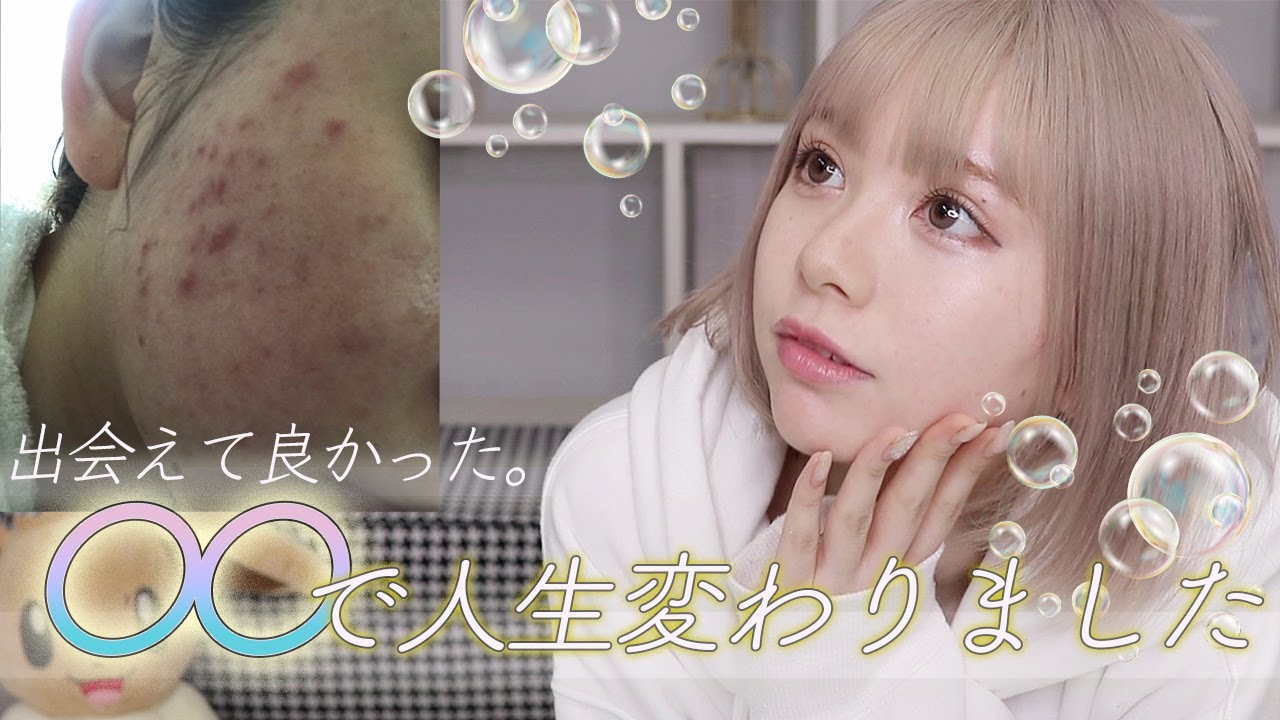 肌荒れに悩んでいる人必見！ニキビが酷かった私が、美肌になった方法！