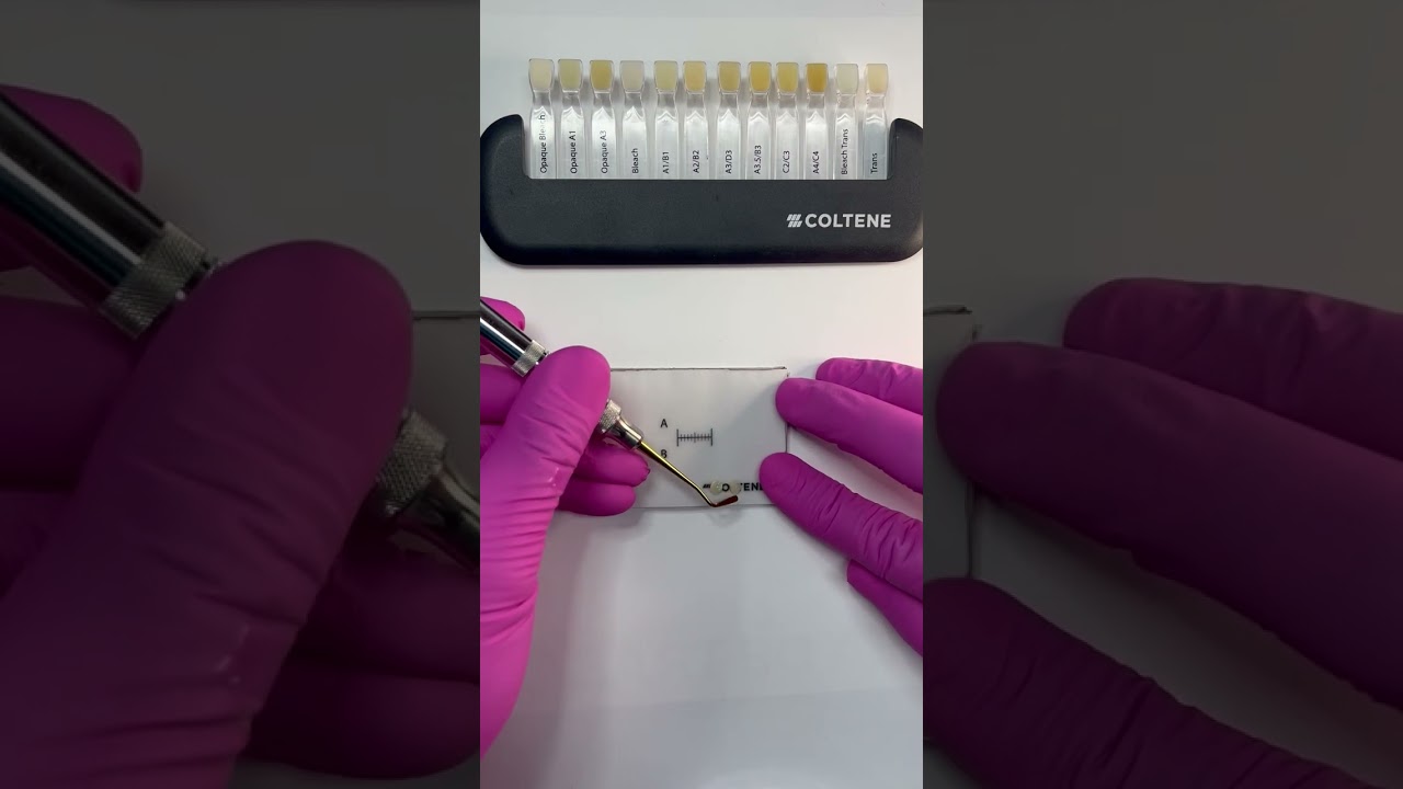 Restauraciones de alta estética con Brilliant Everglow de Coltene