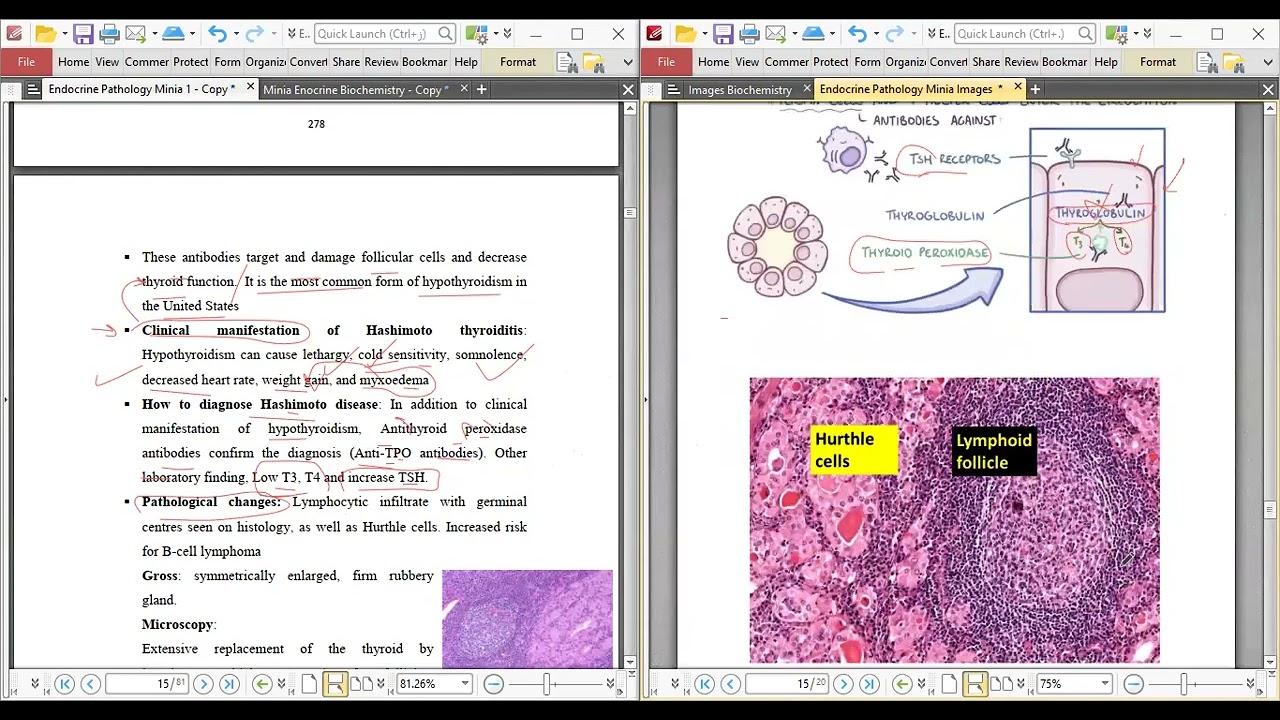 MU3 Endocrine 3 patho Thyroid 2 Biochemistry 1