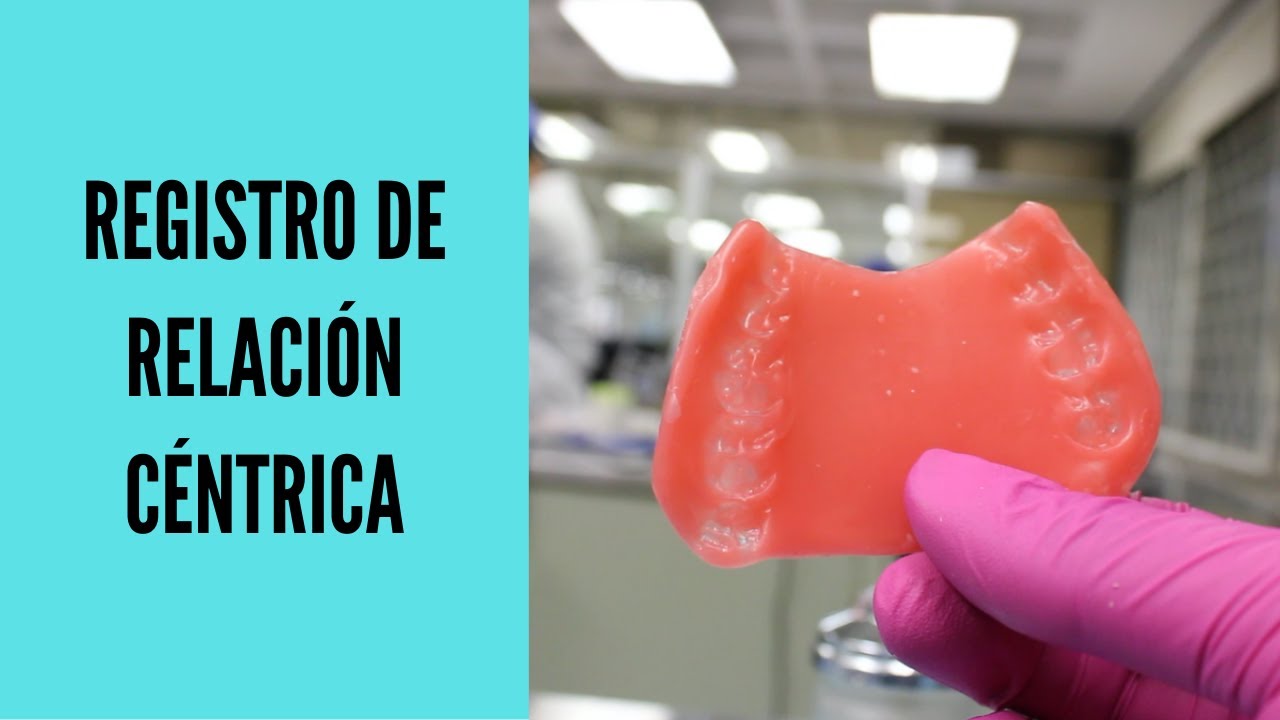 ✅Registro de RELACIÓN CÉNTRICA🦷/Montaje en articulador semiajustable Whip Mix 8500‼️ 2020