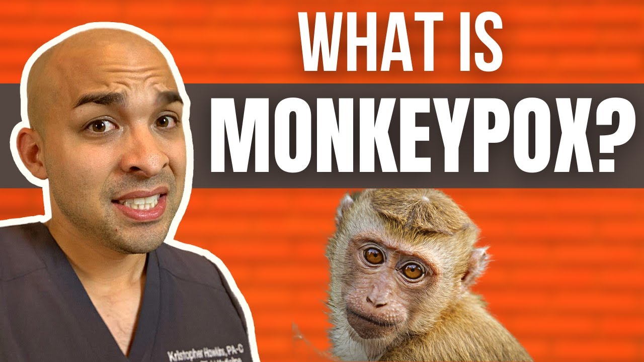 What is Monkeypox? | Everything you need to know about the Monkeypox Virus!