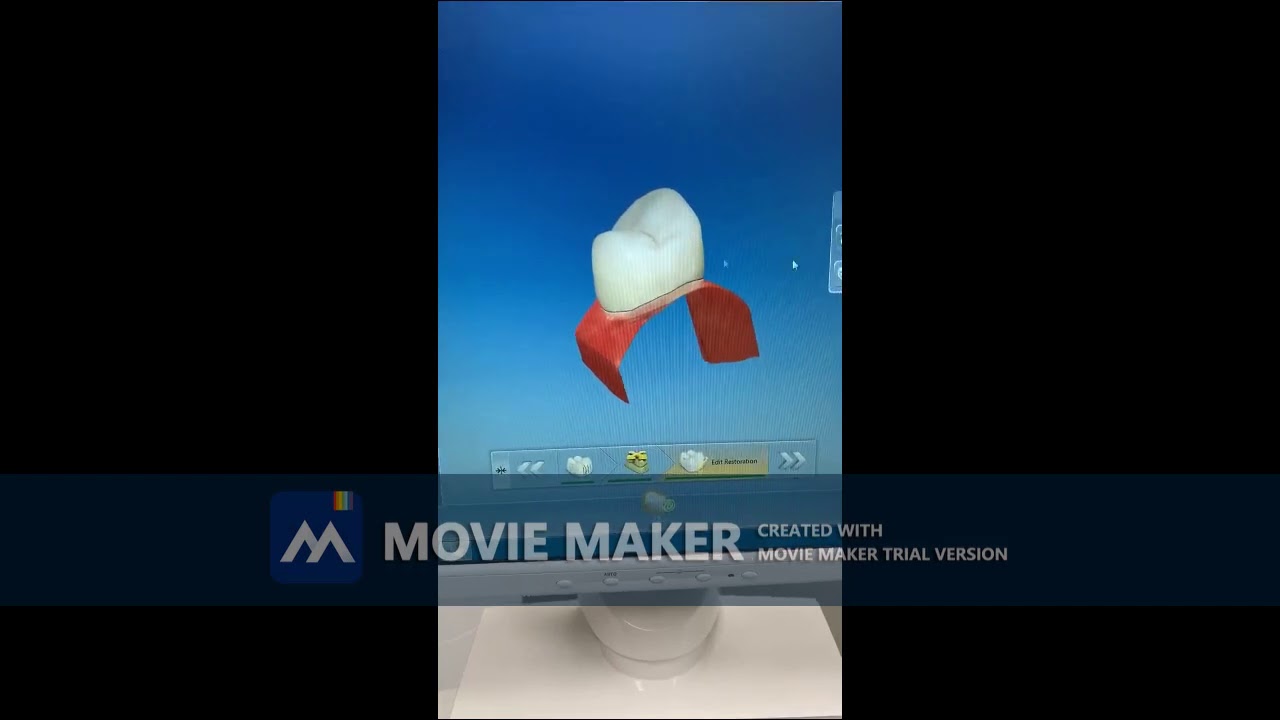 Basic CEREC Design for GDO 213