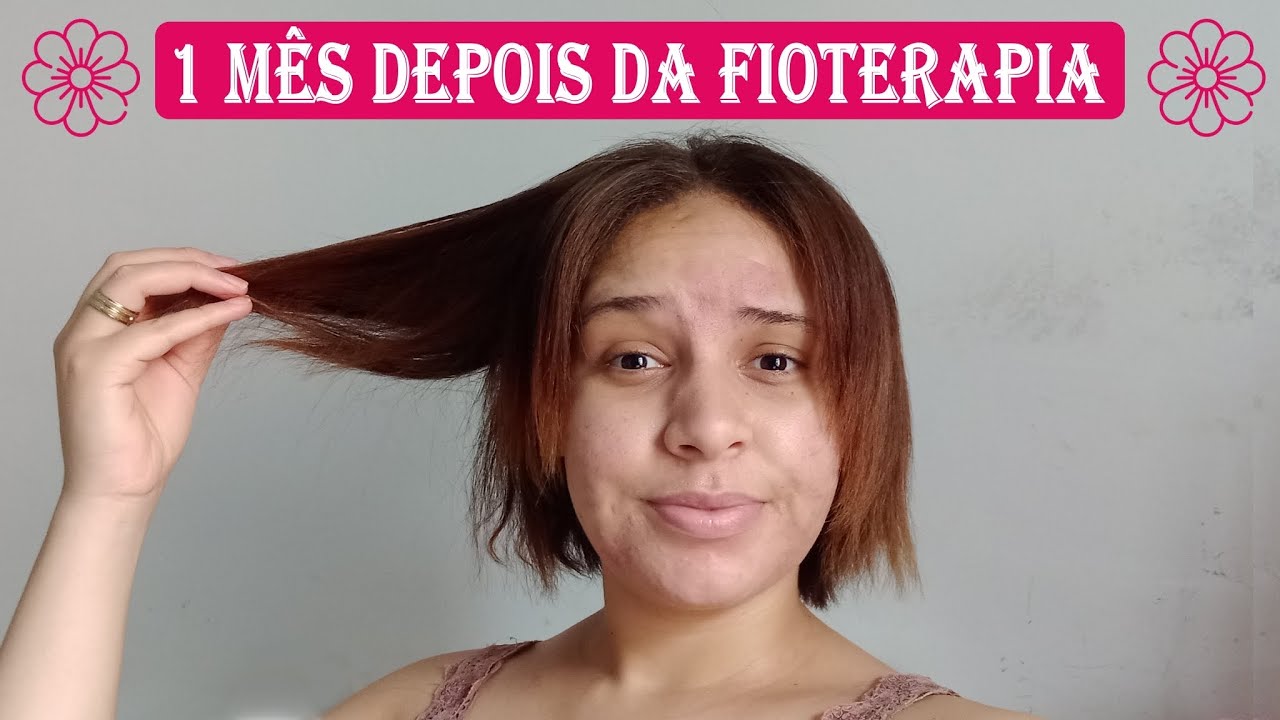 🌸 Segunda aplicação da fioterapia + Durou quanto tempo? 🤔