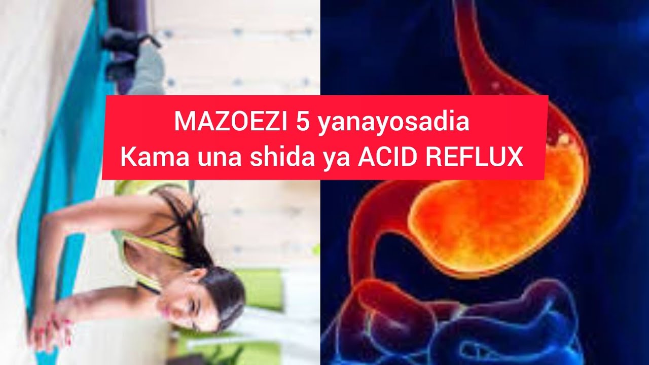 FAHAMU MAZOEZI 5 YANAYO SAIDIA KAMA UNA ACID REFLUX.