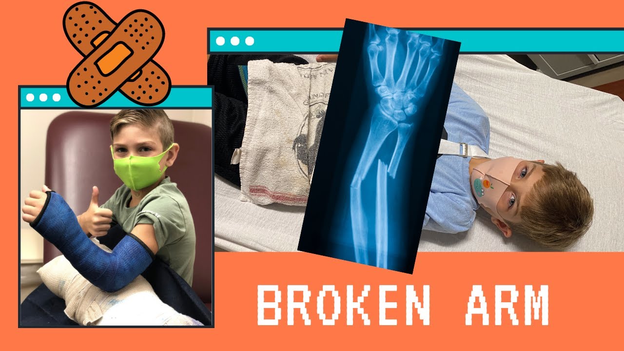 Broken Arm! EMERGENCY!