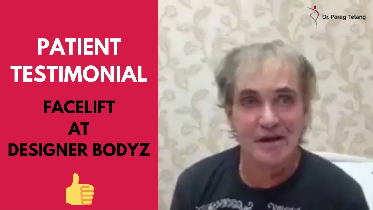 Australian patient who underwent successful Facelift at Designer Bodyz