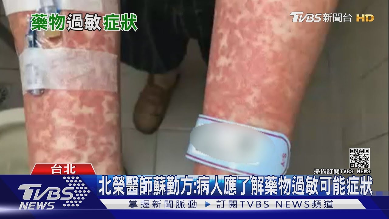 服藥後出現..這可怕