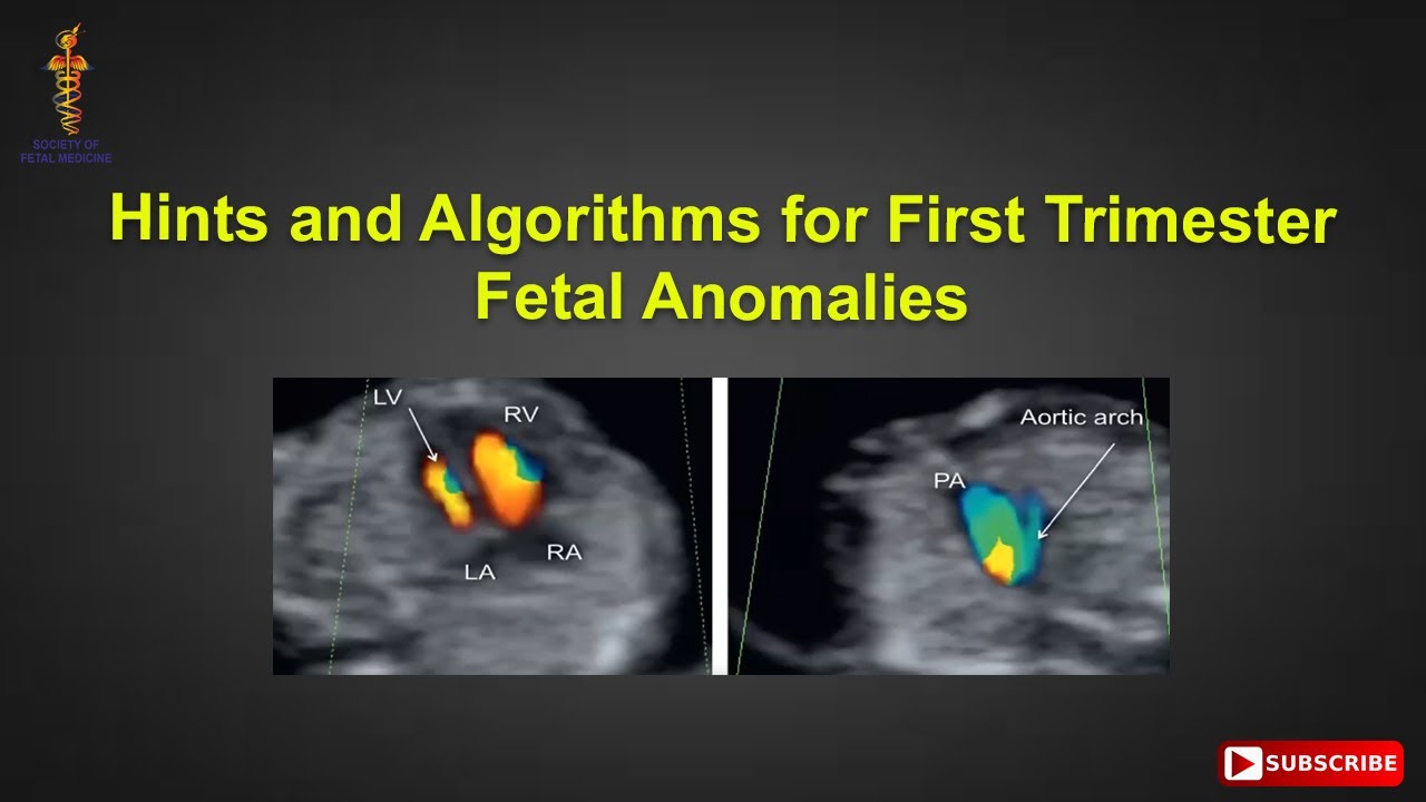 Hints and Algorithms for First Trimester Fetal Anomalies