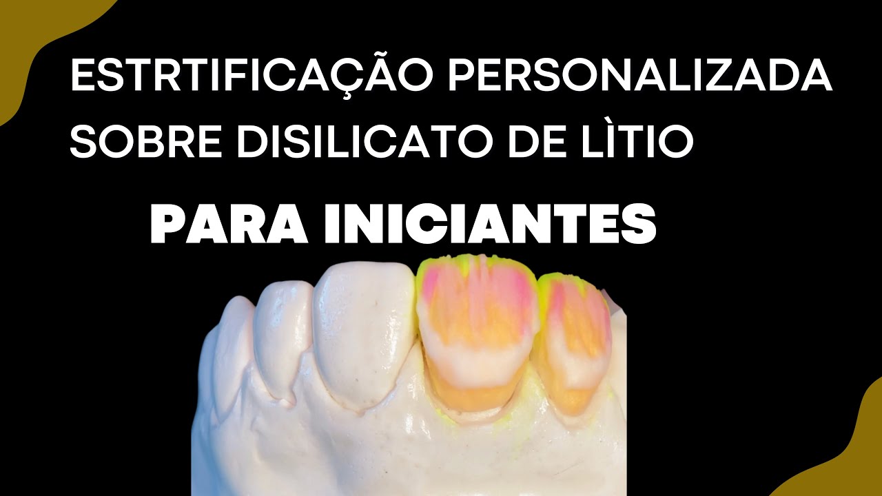 Estratificação personalizada sobre dissilicato de lítio para iniciantes