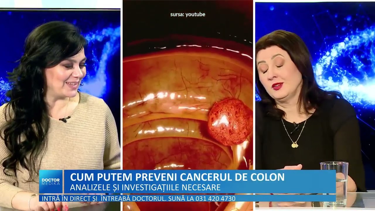 Doctor Medika, PREVENTIE CANCER DE COLON
