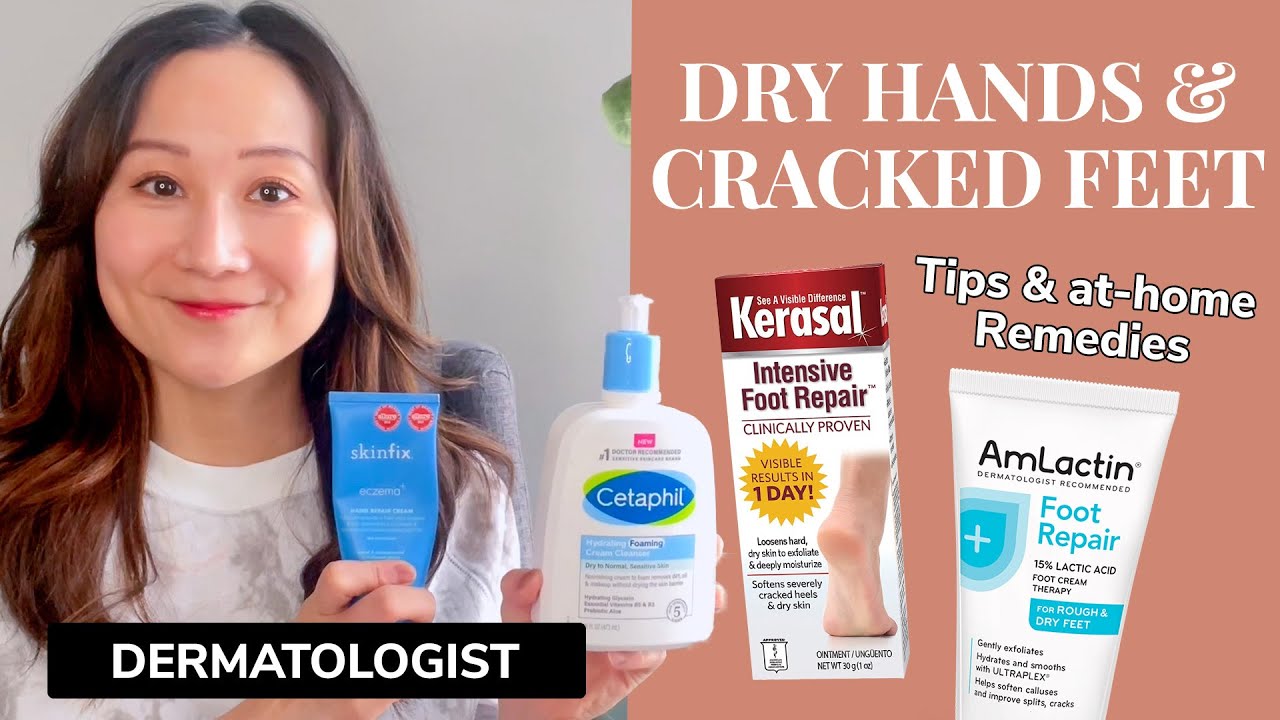 Dermatologist Guide to Dry Hands & Cracked Feet