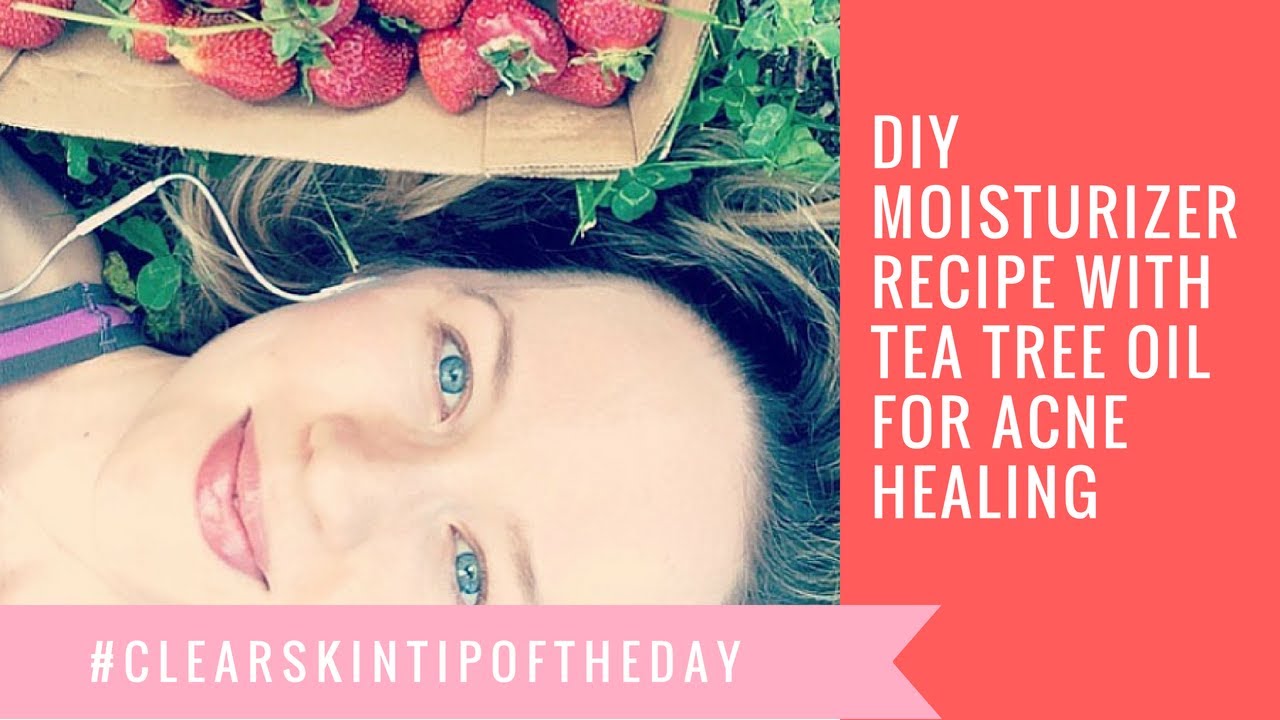 DIY Tea Tree Oil Moisturizer Recipe for Acne Healing