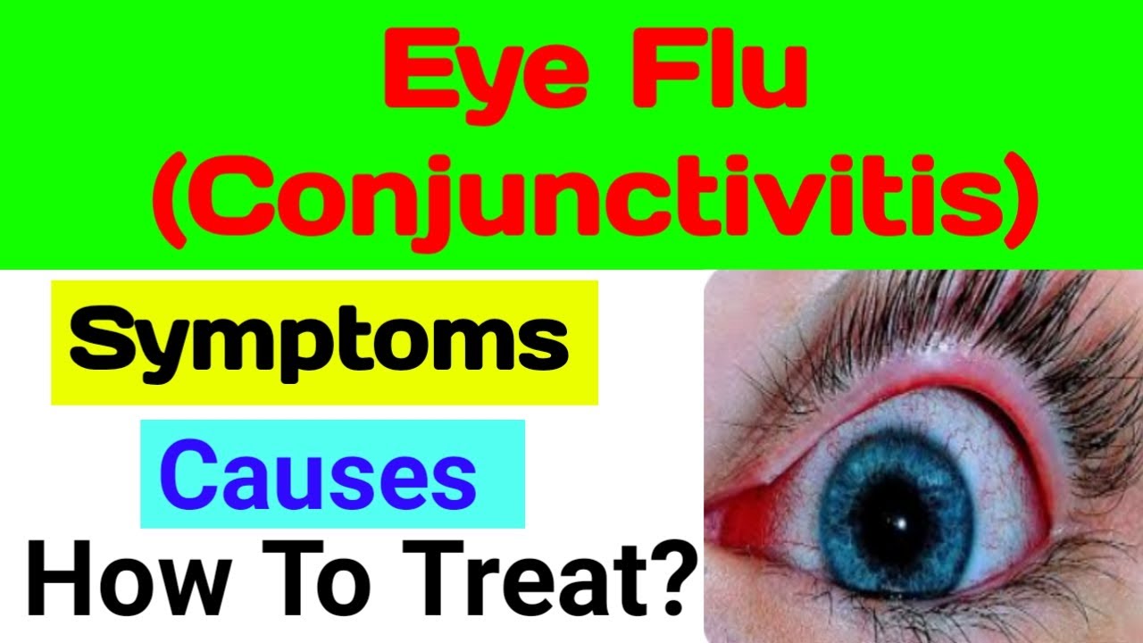 Pink eye | conjunctivitis | conjunctivitis treatment