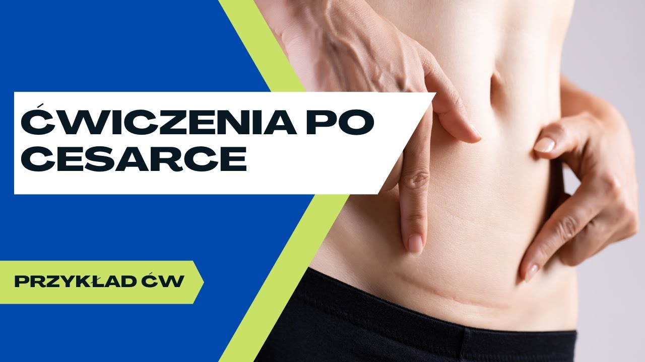 Cięcie cesarskie - przykład ćwiczeń indywidualnych