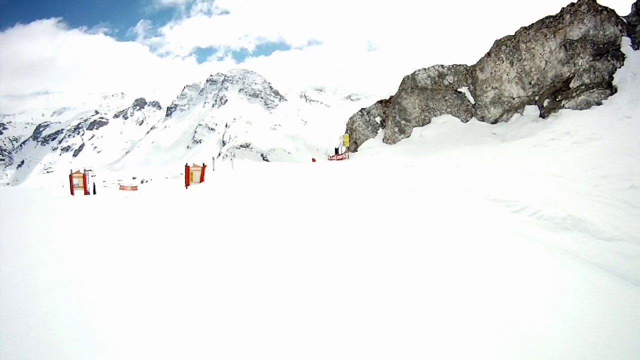 POV Dislocated Shoulder Easter Day in Tignes